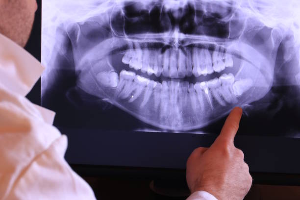 Best Emergency Tooth Extraction in Thurmont, MD